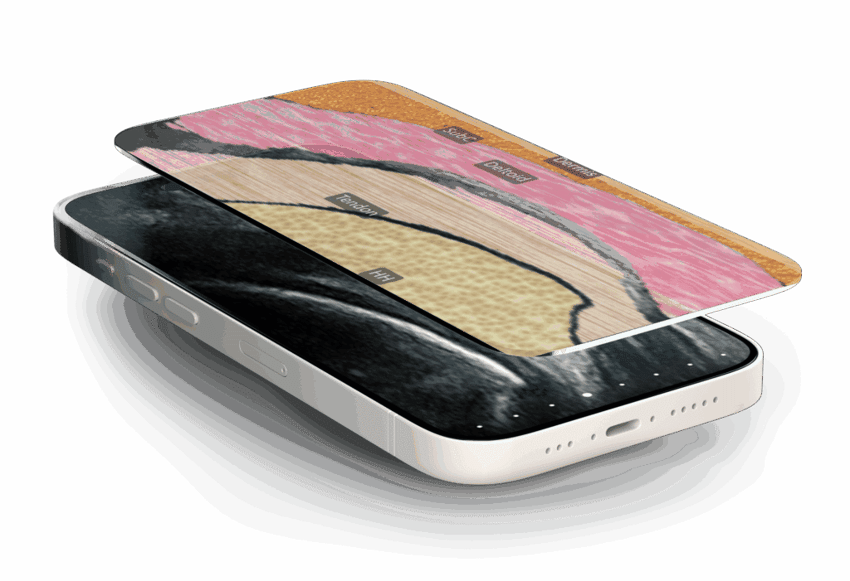 phone_shoulder-tmoded_horizontal-1024x701